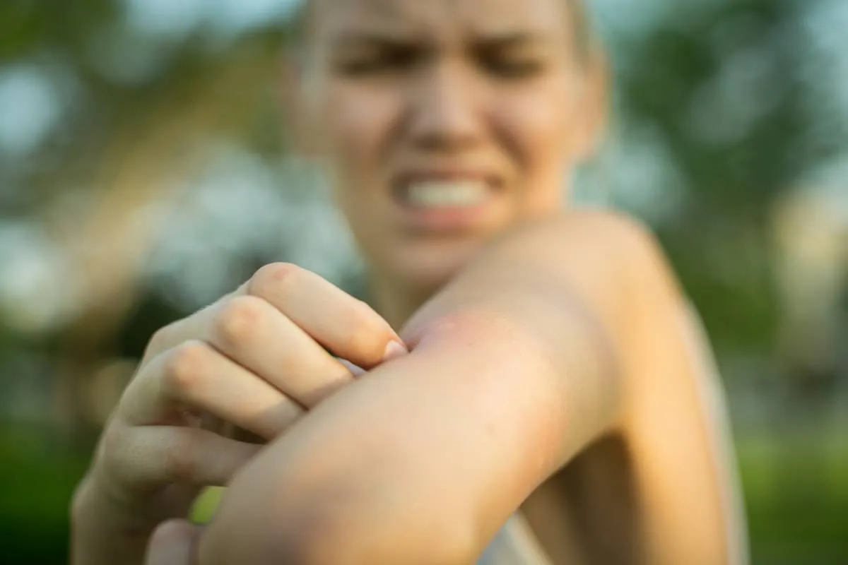 Été : stop aux moustiques